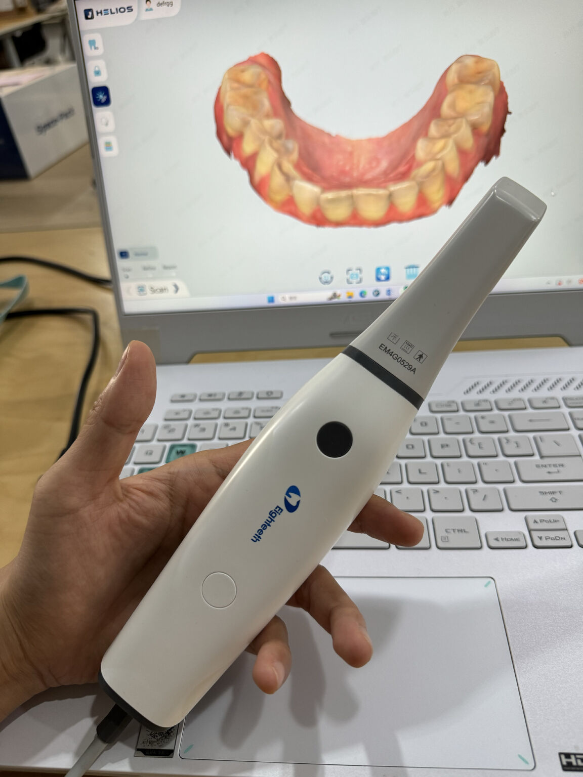 Helios 680 intraoral scanner