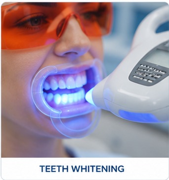 Teeth whitening